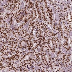 BRD4 Antibody (CL1118), Novus Biologicals 25 &mu;L, Unconjugated:Antibodies,