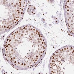BRD4 Antibody (CL1118), Novus Biologicals 25 &mu;L, Unconjugated:Antibodies,