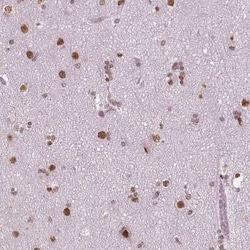 BRD4 Antibody (CL1118), Novus Biologicals:Antibodies:Primary Antibodies