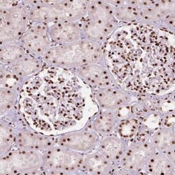 BRD4 Antibody (CL1118), Novus Biologicals 25 &mu;L, Unconjugated:Antibodies,