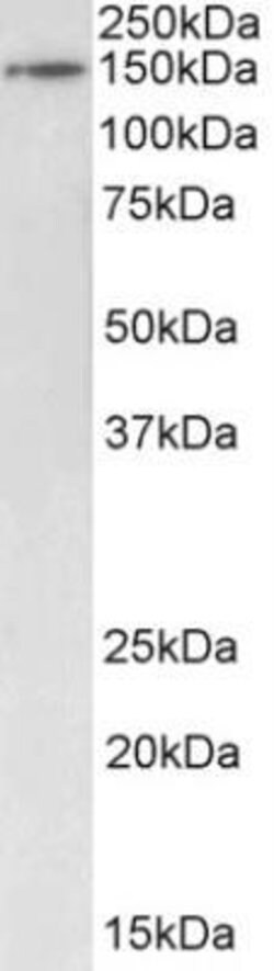 BRD4 Antibody, Novus Biologicals 100 &mu;g; Unconjugated:Antibodies, Polyclonal