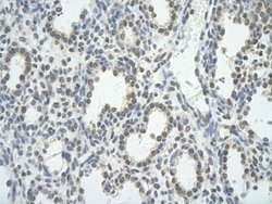 BRD7 Antibody, Novus Biologicals 100 &mu;L; Unconjugated:Antibodies, Polyclonal