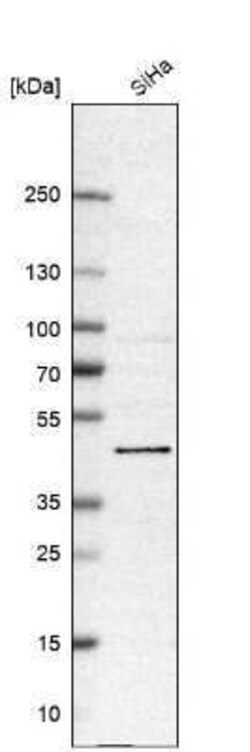 BRD9 Antibody, Novus Biologicals 0.1 mL; Unconjugated:Antibodies, Polyclonal