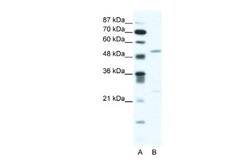 BRD9 Antibody, Novus Biologicals 100 &mu;L | Buy Online | Novus Biologicals | Fisher Scientific