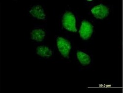BRF1 Antibody, Novus Biologicals 50 &mu;g | Buy Online | Novus Biologicals | Fisher Scientific