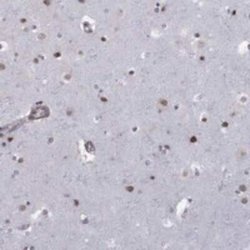 BRF1 Rabbit anti-Human, Polyclonal, Novus Biologicals 25 &mu;g; Unconjugated:Antibodies,
