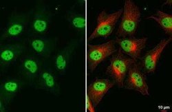 BRM Antibody (HL1115), Novus Biologicals 100 &mu;g; Unconjugated:Antibodies,