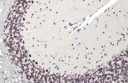 BRM Antibody (HL1115), Novus Biologicals 100 &mu;g; Unconjugated:Antibodies,
