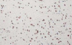 BRM Antibody (HL1115), Novus Biologicals 100 &mu;g; Unconjugated:Antibodies,