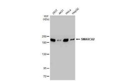 BRM Antibody (HL1115), Novus Biologicals 100 &mu;g; Unconjugated:Antibodies,
