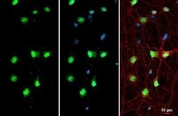 BRM Antibody, Novus Biologicals 100 &mu;g; Unconjugated:Antibodies, Polyclonal