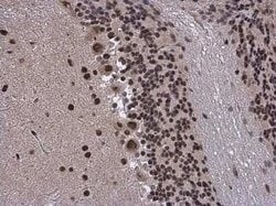 BRM Antibody, Novus Biologicals 100 &mu;g; Unconjugated:Antibodies, Polyclonal