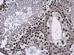 BRM Antibody, Novus Biologicals 100 &mu;g; Unconjugated:Antibodies, Polyclonal