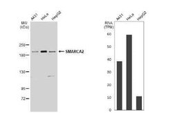 BRM Antibody, Novus Biologicals 100 &mu;g; Unconjugated:Antibodies, Polyclonal