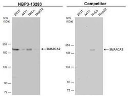 BRM Antibody, Novus Biologicals 100 &mu;g; Unconjugated:Antibodies, Polyclonal