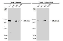BRM Antibody, Novus Biologicals 100 &mu;g; Unconjugated:Antibodies, Polyclonal