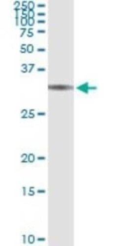 BRMS1 Antibody (2D4-2G11), Novus Biologicals 0.1 mg | Buy Online | Novus Biologicals | Fisher Scientific