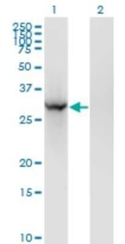 BRMS1 Antibody (2D4-2G11), Novus Biologicals 0.1 mg | Buy Online | Novus Biologicals | Fisher Scientific