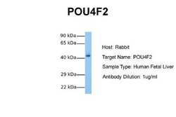 BRN3B/POU4F2 Rabbit anti-Human, Polyclonal, Novus Biologicals 0.1ml; Unconjugated:Antibodies,