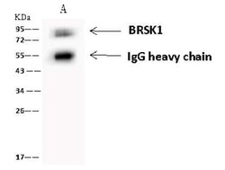 BRSK1 Antibody, Novus Biologicals 100 &mu;g, Unconjugated:Antibodies, Polyclonal