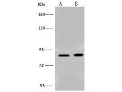 BRSK1 Antibody, Novus Biologicals 100 &mu;g, Unconjugated:Antibodies, Polyclonal