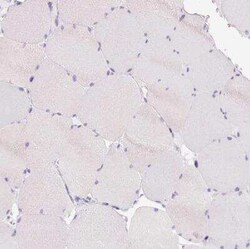 BSND Antibody, Novus Biologicals:Antibodies:Primary Antibodies