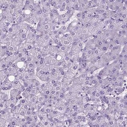 BSND Antibody, Novus Biologicals:Antibodies:Primary Antibodies