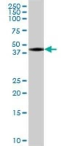 BSPRY Antibody, Novus Biologicals 50 &mu;g | Buy Online | Novus Biologicals | Fisher Scientific