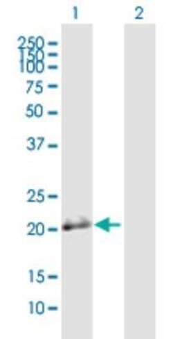 BSPRY Antibody, Novus Biologicals 50 &mu;g | Buy Online | Novus Biologicals | Fisher Scientific