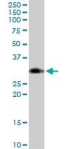 BST2 Antibody, Novus Biologicals 0.05 mg | Buy Online | Novus Biologicals | Fisher Scientific