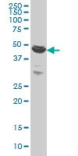 Novus Biologicals BTBD1 Antibody (3E11), Novus Biologicals 0.1 mg | Buy Online | Novus Biologicals&trade; | Fisher Scientific