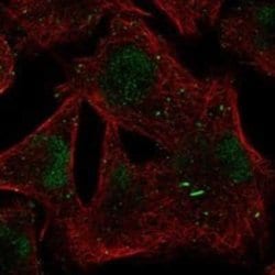 BTBD1 Rabbit anti-Human, Polyclonal, Novus Biologicals:Antibodies:Primary