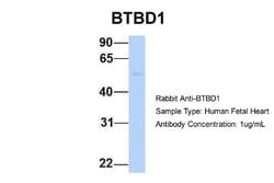 BTBD1 Antibody, Novus Biologicals 100 &mu;L; Unconjugated:Antibodies, Polyclonal