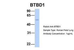 BTBD1 Antibody, Novus Biologicals 100 &mu;L; Unconjugated:Antibodies, Polyclonal
