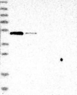 BTBD1 Rabbit anti-Human, Polyclonal, Novus Biologicals:Antibodies:Primary