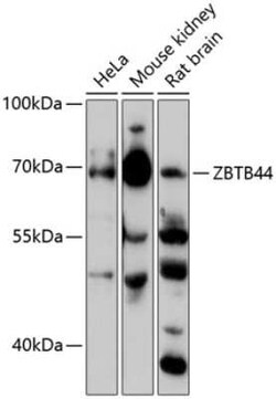 BTBD15 Antibody - Azide and BSA Free, Novus Biologicals:Antibodies:Primary