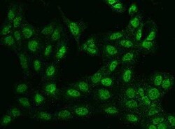 BTBD9 Antibody, Novus Biologicals:Antibodies:Primary Antibodies