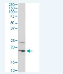 BTF3L4 Antibody (2G10), Novus Biologicals 100 &mu;g | Buy Online | Novus Biologicals | Fisher Scientific