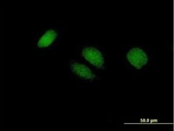 BTG4 Antibody, Novus Biologicals 0.05 mg | Buy Online | Novus Biologicals | Fisher Scientific