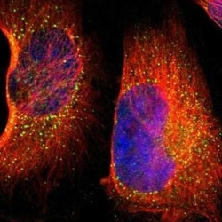 BTK Antibody, Novus Biologicals 0.1 mL | Buy Online | Novus Biologicals | Fisher Scientific