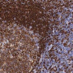 BTK Antibody, Novus Biologicals 0.1 mL | Buy Online | Novus Biologicals | Fisher Scientific
