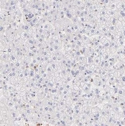 BTK Antibody, Novus Biologicals 0.1 mL; Unconjugated:Antibodies, Polyclonal