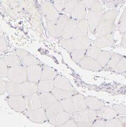 BTK Antibody, Novus Biologicals 0.1 mL; Unconjugated:Antibodies, Polyclonal