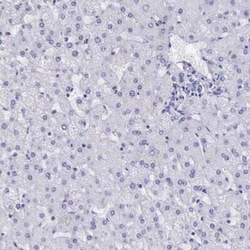BTK Antibody, Novus Biologicals 0.1 mL | Buy Online | Novus Biologicals | Fisher Scientific