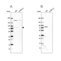 BTK Antibody, Novus Biologicals 0.1 mL; Unconjugated:Antibodies, Polyclonal