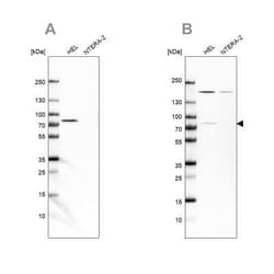 BTK Antibody, Novus Biologicals 0.1 mL | Buy Online | Novus Biologicals | Fisher Scientific