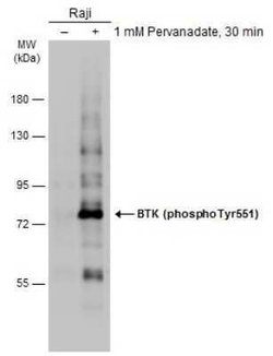 BTK, p Tyr551 Antibody, Novus Biologicals 100 &mu;g | Buy Online | Novus Biologicals | Fisher Scientific