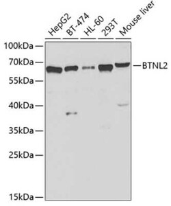 BTNL2/Butyrophilin-like 2 Antibody - Azide and BSA Free, Novus Biologicals