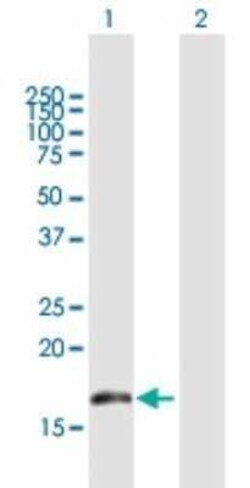 BUD31 Antibody, Novus Biologicals 0.05 mg | Buy Online | Novus Biologicals | Fisher Scientific