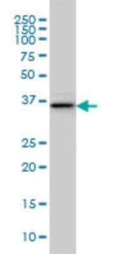 BVES Antibody (3F7), Novus Biologicals 0.1 mg | Buy Online | Novus Biologicals | Fisher Scientific